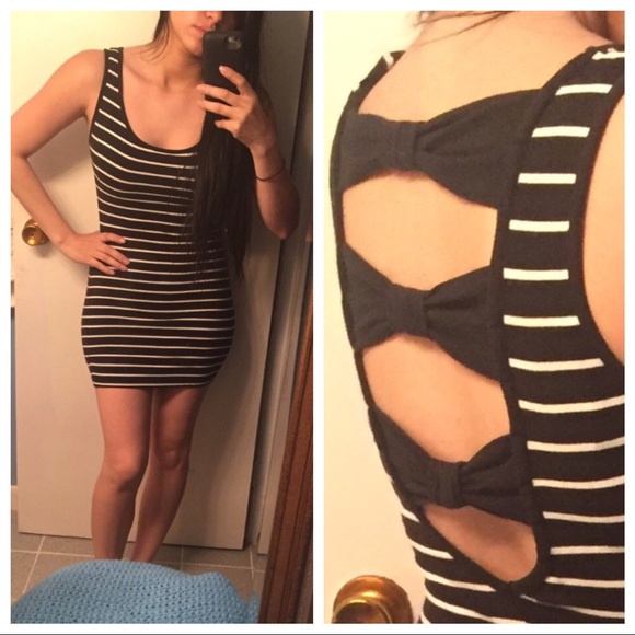 Forever 21 stripe dress with back detail - Picture 1 of 3